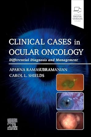 Clinical Cases in Ocular Oncology: Differential Diagnosis and Management