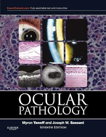 Ocular Pathology: Expert Consult