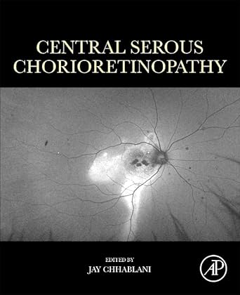Central Serous Chorioretinopathy