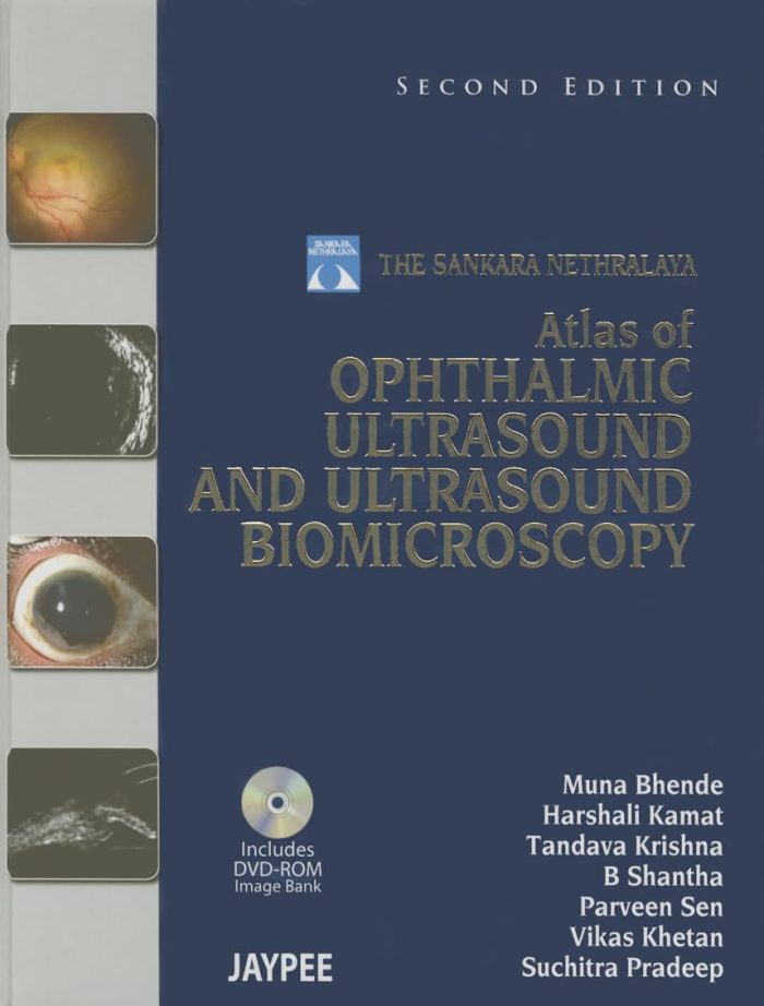 The Sankara Nethralaya Atlas of Ophthalmic Ultrasound and Ultrasound Biomicroscopy