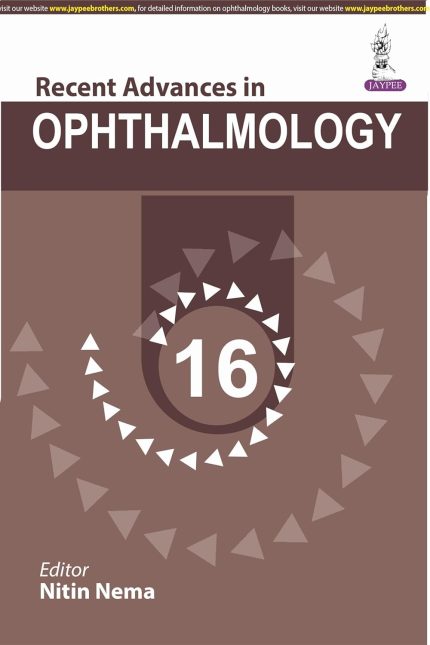 Recent Advances in Ophthalmology 16