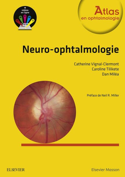 Neuro-ophtalmologie (Atlas en Ophtalmologie) (French Edition)