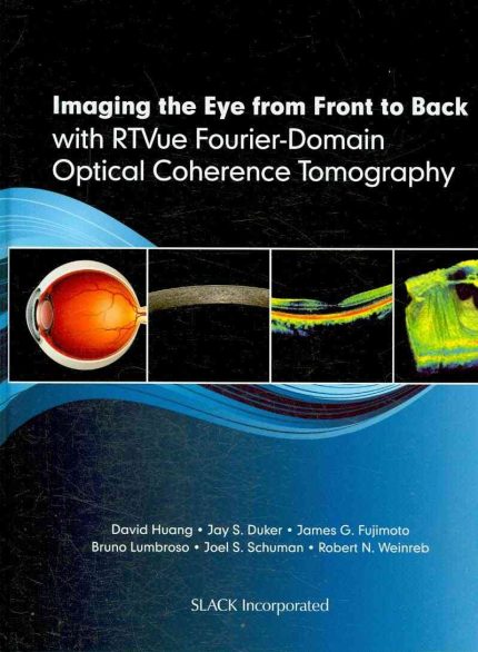 Imaging the Eye from Front to Back with RTVue Fourier-Domain Optical Coherence Tomogaphy