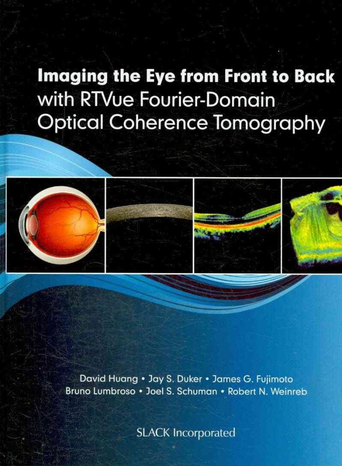 Imaging the Eye from Front to Back with RTVue Fourier-Domain Optical Coherence Tomogaphy