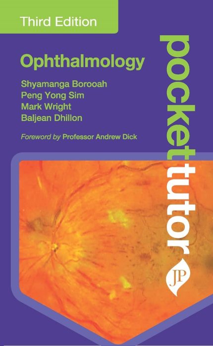 Pocket Tutor Ophthalmology: Third Edition