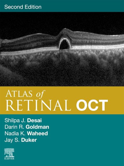 Atlas of Retinal OCT E-Book: Optical Coherence Tomography