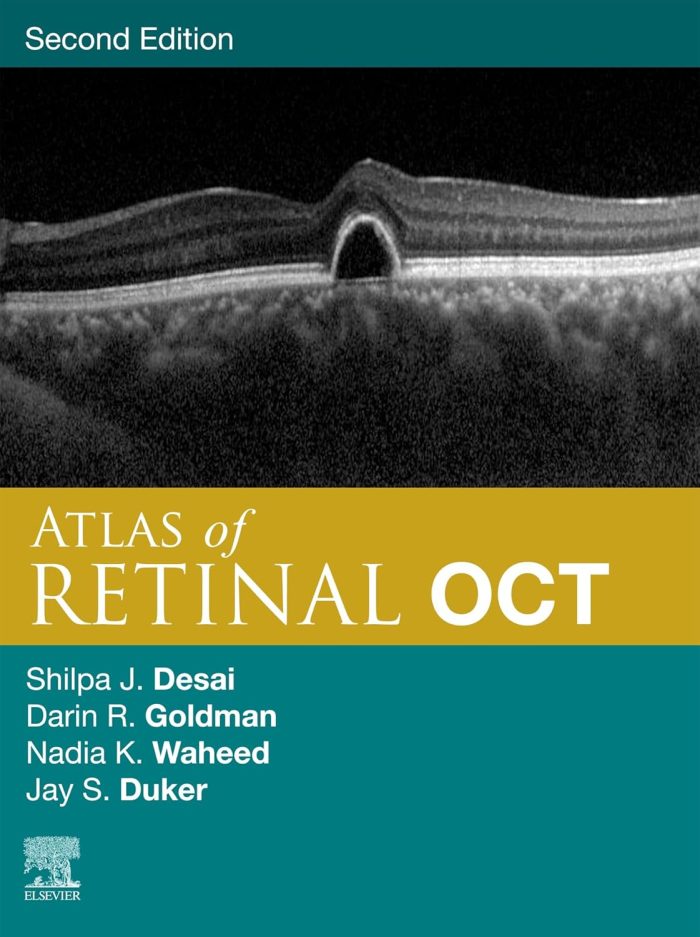Atlas of Retinal OCT E-Book: Optical Coherence Tomography