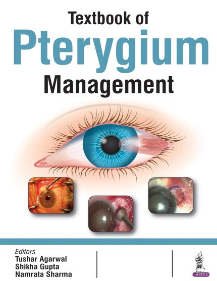 Textbook of Pterygium Management