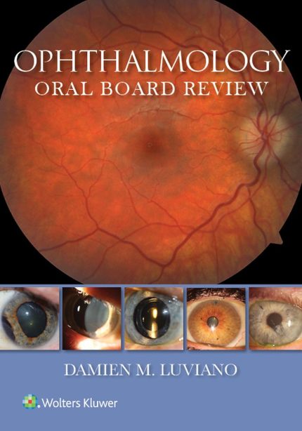 Ophthalmology Oral Board Review