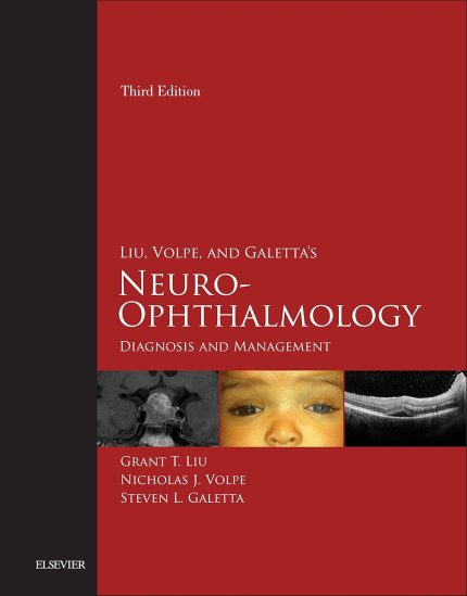 Liu, Volpe, and Galetta’s Neuro-Ophthalmology: Diagnosis and Management