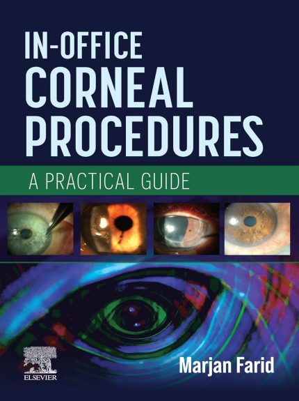In-Office Corneal Procedures - E-BOOK: A Practical Guide