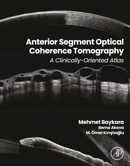 Anterior Segment Optical Coherence Tomography: A Clinically-Oriented Atlas
