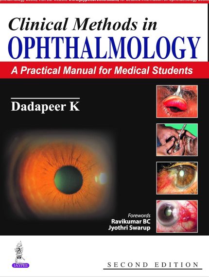 Clinical Methods in Ophthalmology: A Practical Manual for Medical Students