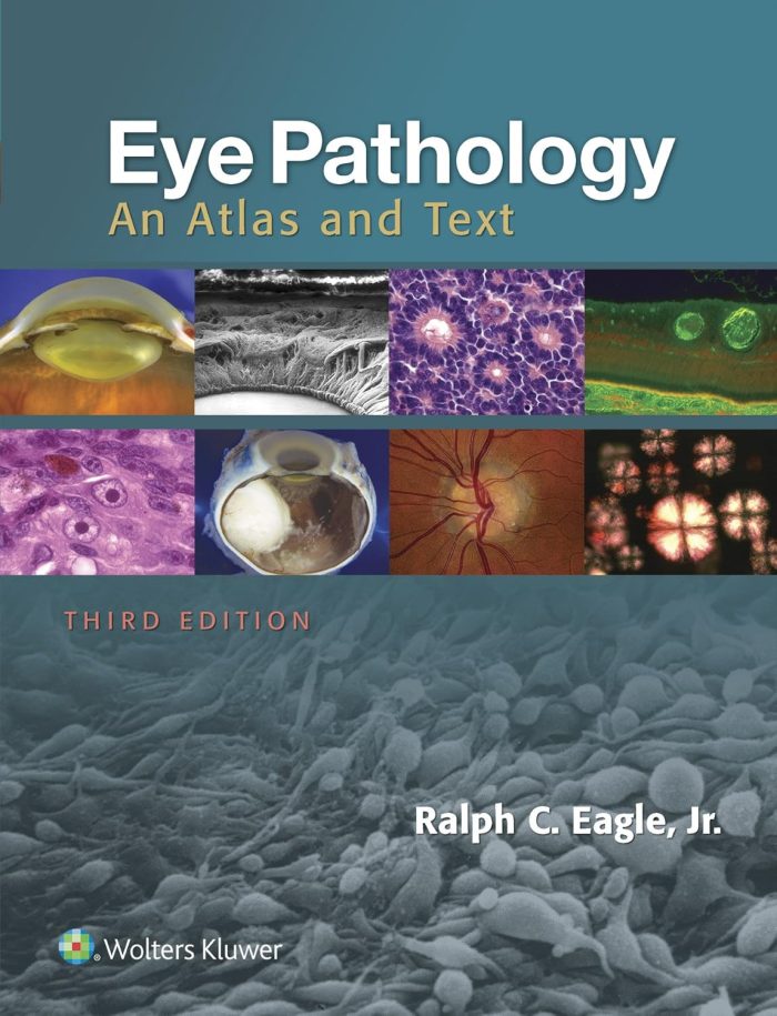 Eye Pathology: An Atlas and Text