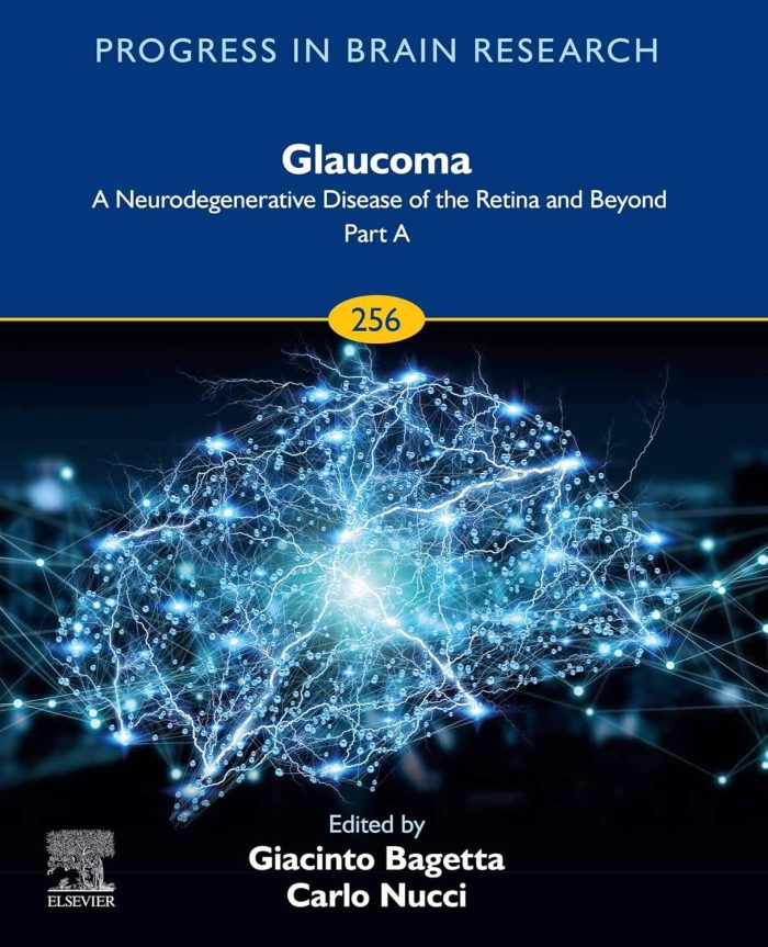 Glaucoma: A Neurodegenerative Disease of the Retina and Beyond: Part A (Progress in Brain Research Book 256)