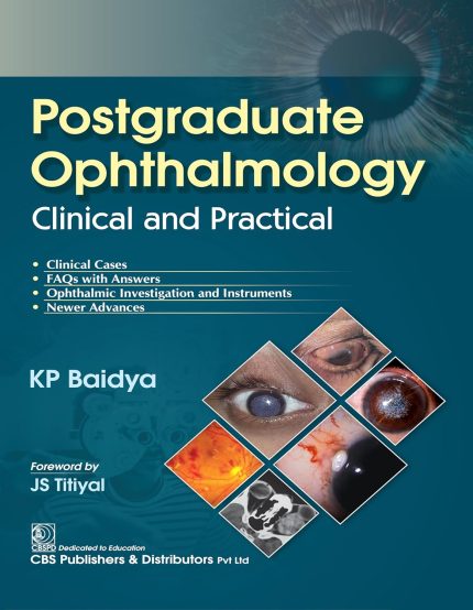 Postgraduate Ophthalmology Clinical and Practical