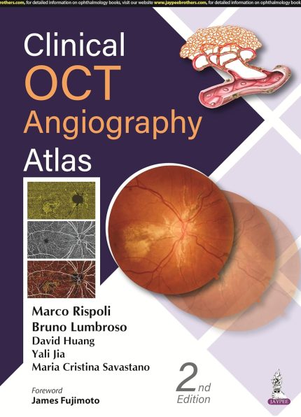 Clinical OCT Angiography Atlas