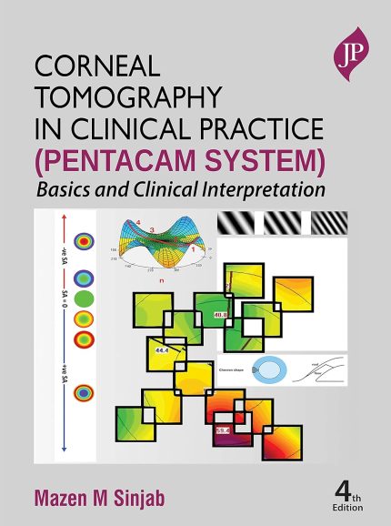 Corneal Tomography in Clinical Practice (Pentacam System): Basics and Clinical Interpretation