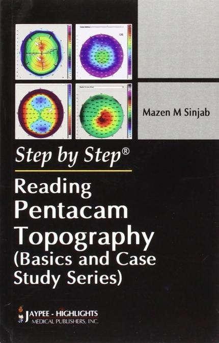 Reading Pentacam Topography (Step by Step: Basics and Case Study Series)