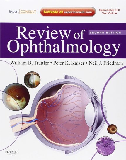 Review of Ophthalmology: Expert Consult