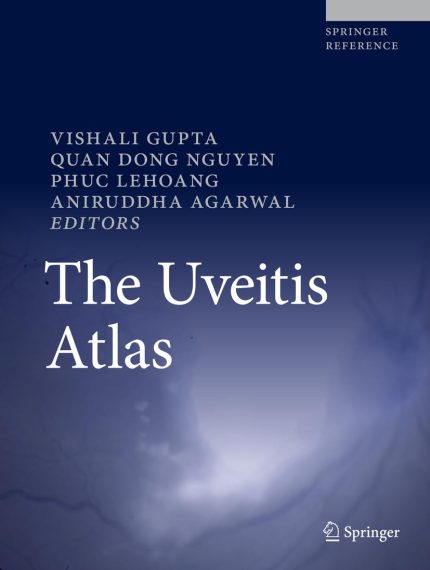The Uveitis Atlas (English Edition)