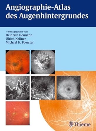 Angiographie- Atlas des Augenhintergrundes.