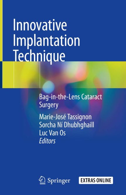 Innovative Implantation Technique: Bag-in-the-Lens Cataract Surgery (English Edition)