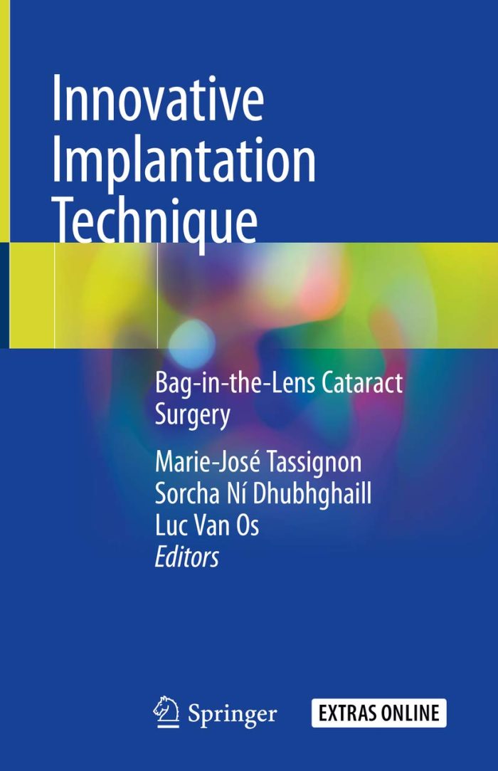 Innovative Implantation Technique: Bag-in-the-Lens Cataract Surgery (English Edition)