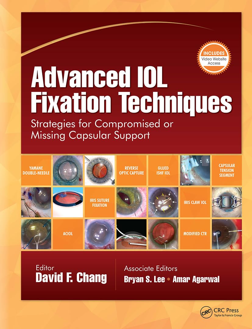 Advanced IOL Fixation Techniques: Strategies for Compromised or Missing Capsular Support (PDF + Videos)