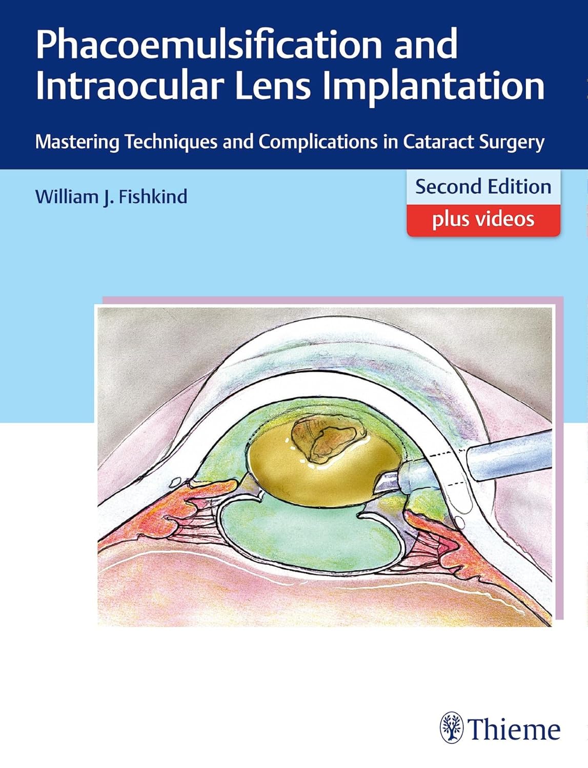 Phacoemulsification and Intraocular Lens Implantation: Mastering Techniques and Complications in Cataract Surgery