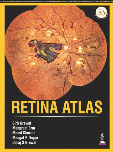 Retina Atlas