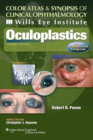 Oculoplastics: Color Atlas & Synopsis of Clinical Ophthalmology (Wills Eye Institute Atlas Series)