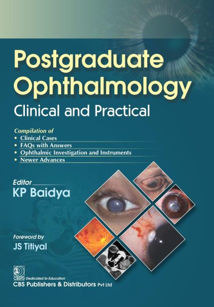 Postgraduate Ophthalmology Clinical And Practical (Pb 2024)