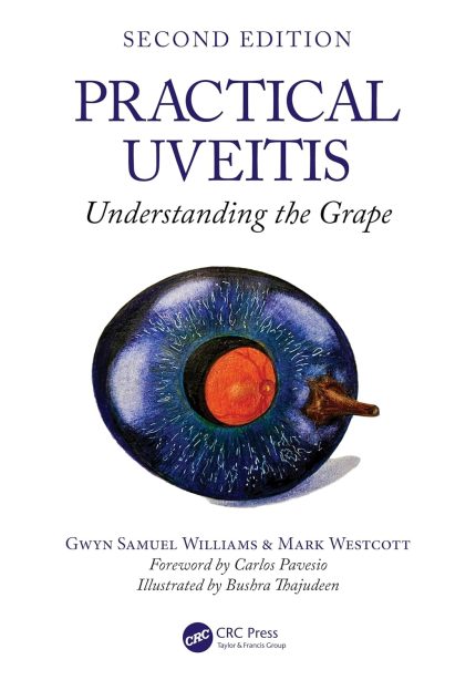 Practical Uveitis: Understanding the Grape