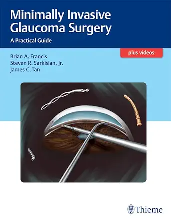 Minimally Invasive Glaucoma Surgery: A Practical Guide