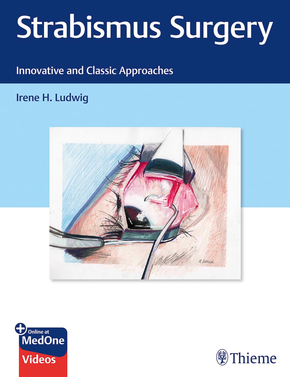 Strabismus Surgery: Innovative and Classic Approaches (only PDF)