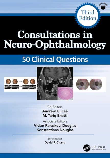Consultations in Neuro-Ophthalmology: 50 Clinical Questions (Curbside Consultation in Ophthalmology)