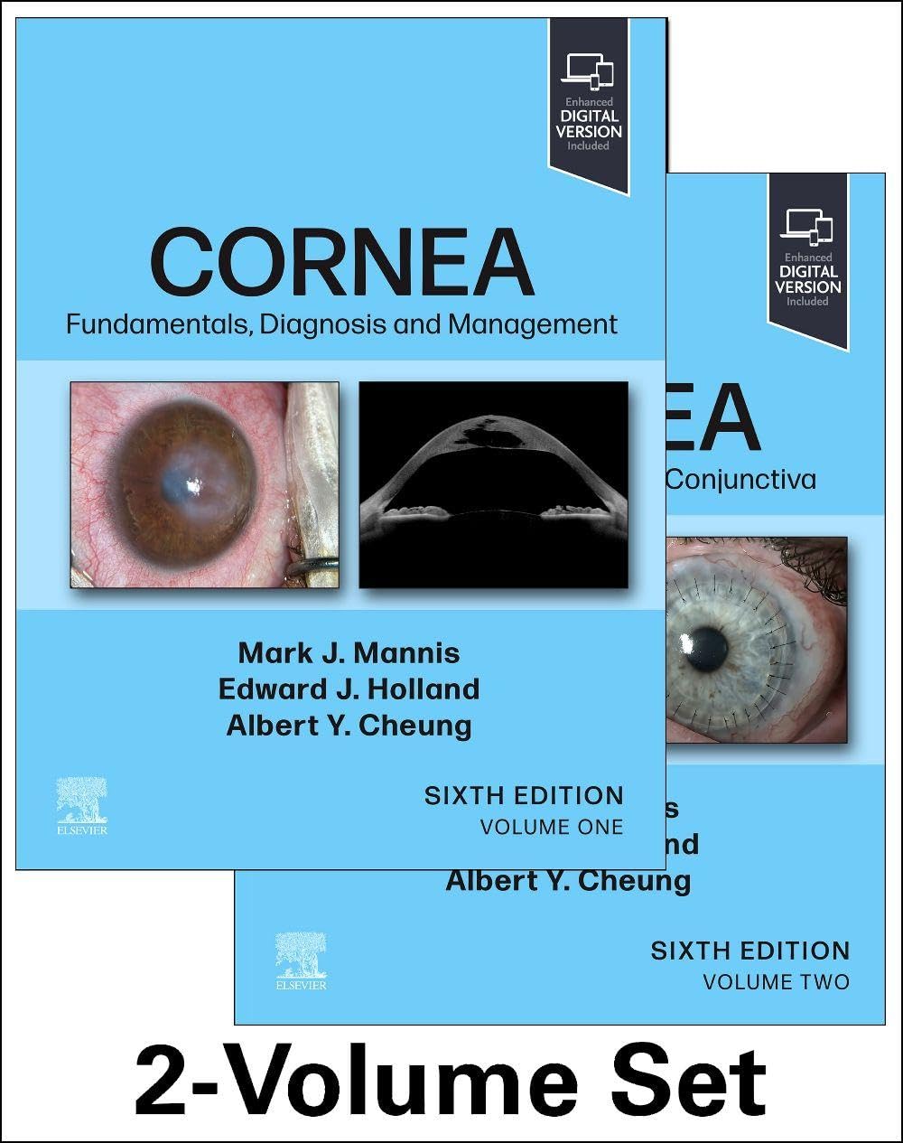 Cornea, 2-Volume Set